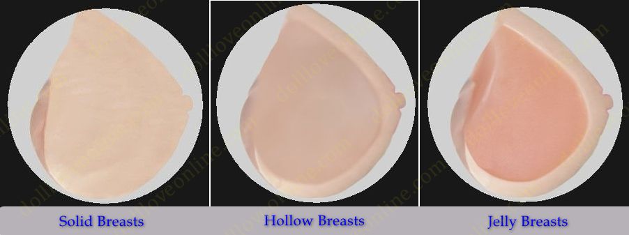 Breast Types
